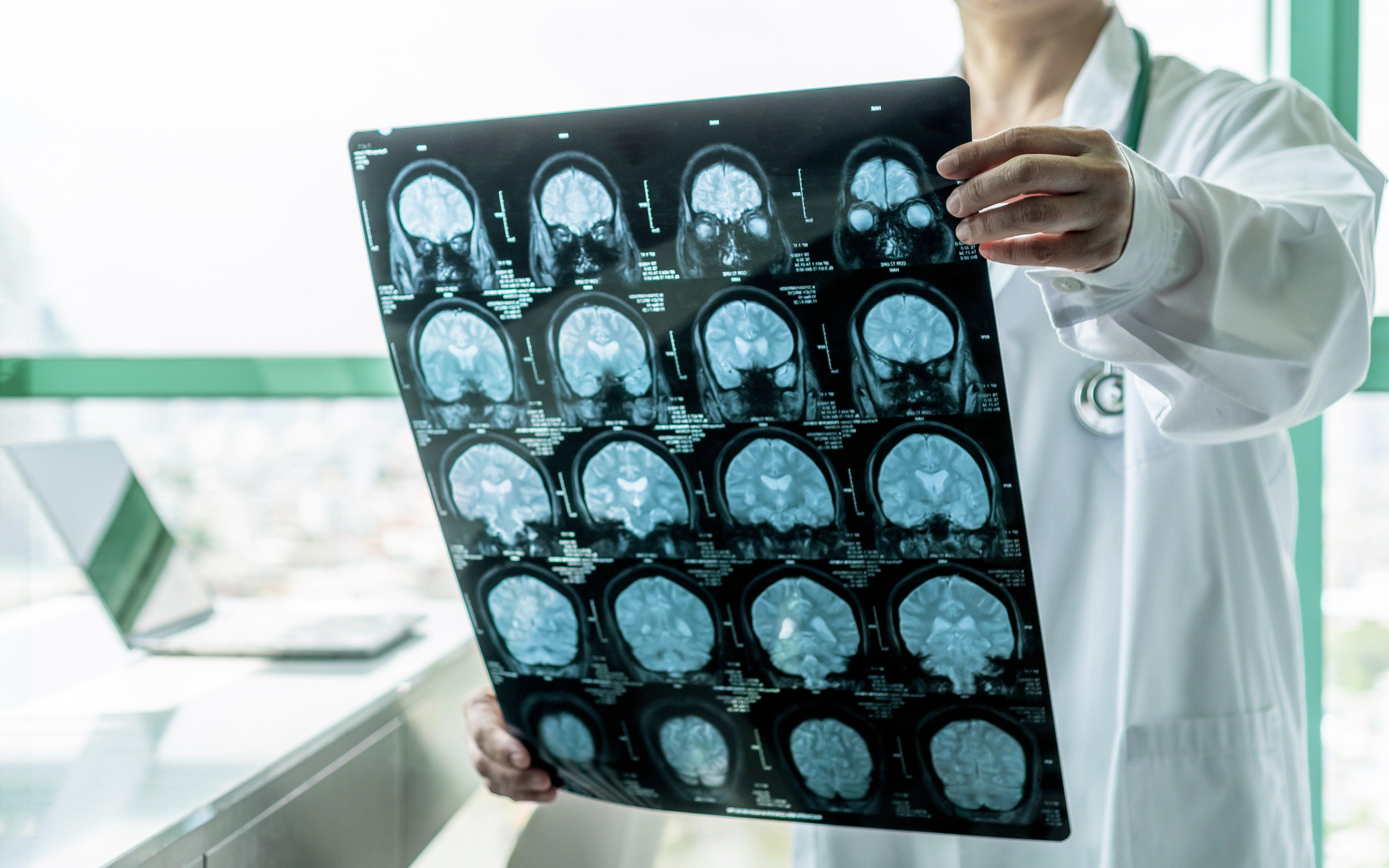 How to upgrade your brain with Psilocybin - Earth Resonance